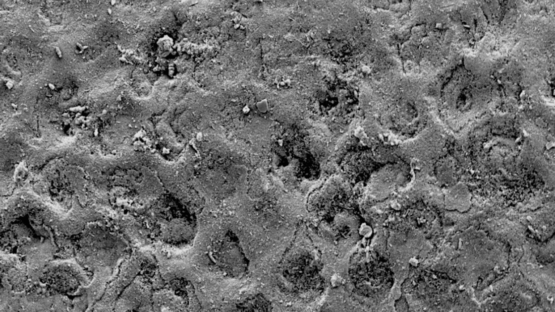 SCHMELZOBERFLÄCHE MIT BIOFILMRESTEN VOR DER REINIGUNG.